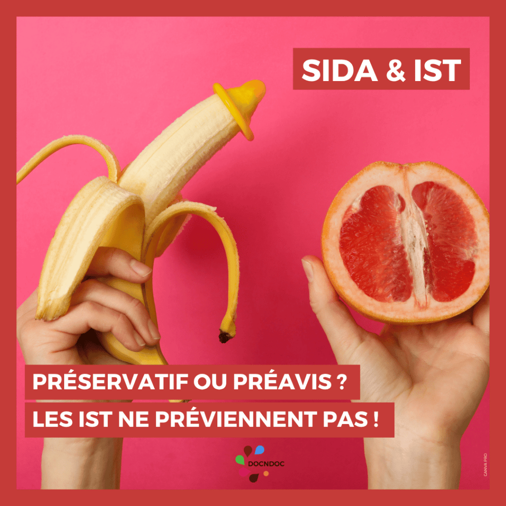 Sida et IST
